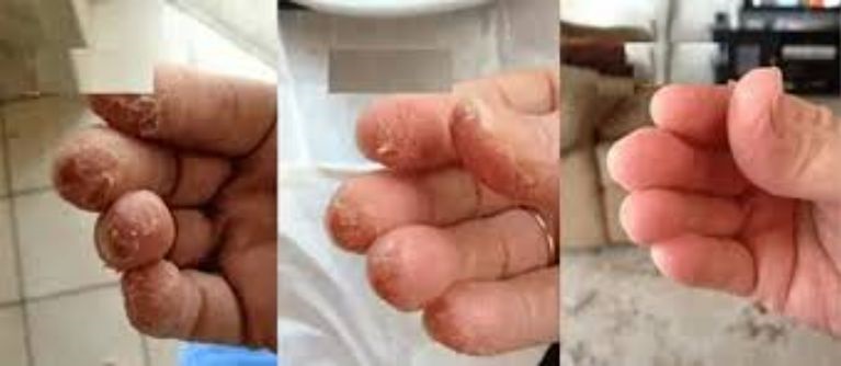 bột thông cống dính vào tay