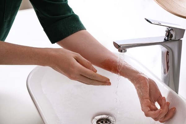 Cách sơ cứu khi bột thông cống dính vào tay